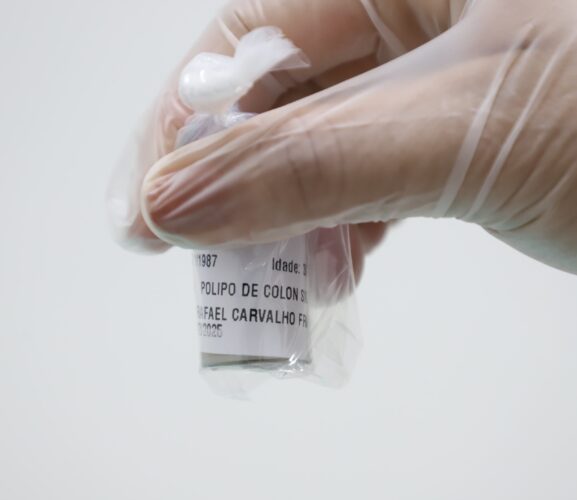 Saúde Estadual promove mutirão de prevenção ao câncer de intestino