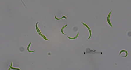 Microalga remove resquícios de antibióticos da água, diminuindo contaminação do meio ambiente