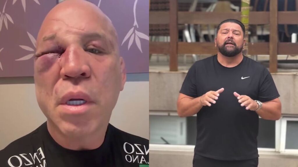 Defesa de Wanderlei Silva formalizará queixa-crime contra Popó Freitas por agressão pós-luta