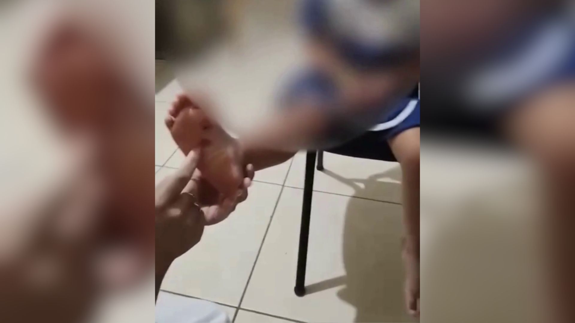 Padrasto é suspeito de queimar pé de enteada de 4 anos com isqueiro