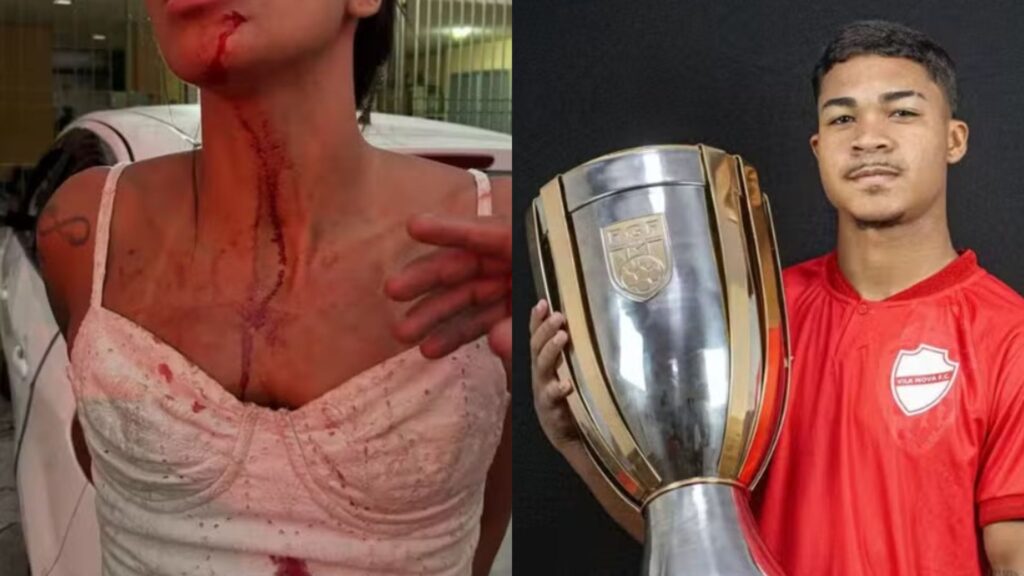 Mulher acusa atacante do Vila Nova de agressão em bar no Rio