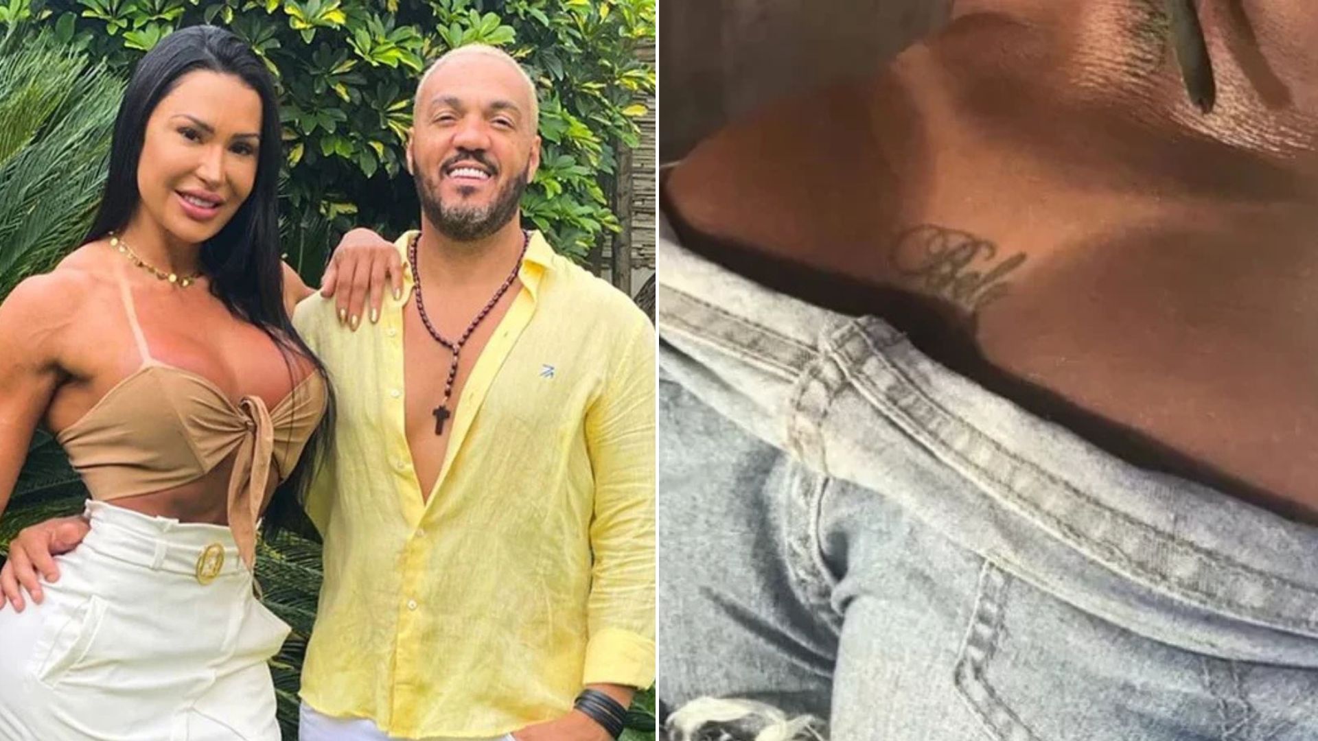 Gracyanne inicia remoção de tatuagem com nome de Belo 2 anos após fim do casamento