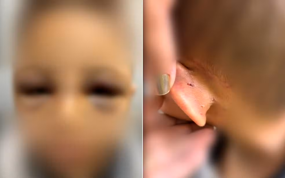 Pai espanca filho de 6 anos e é preso em flagrante em Goiânia