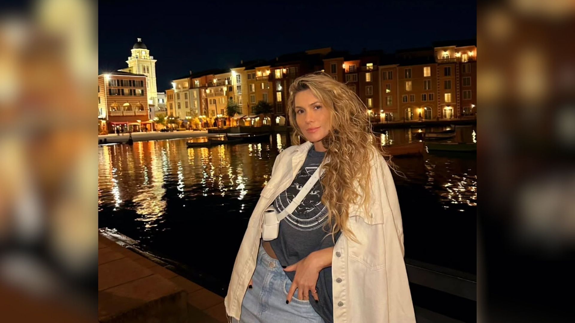 Lívia Andrade revela diagnóstico de nevralgia do trigêmeo: “pior dor da vida”