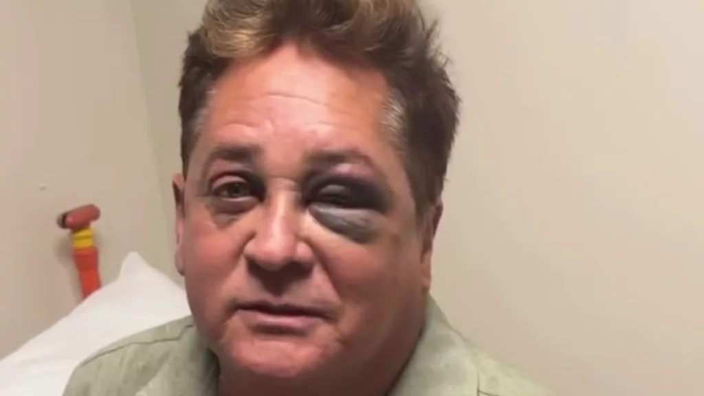 Após queda em pescaria, cantor Leonardo passa por avaliação médica em Goiânia